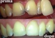 studio-dentistico-allitto-implantologia-dentale-messina-(8).jpg
